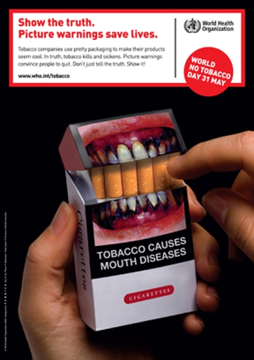 A poster showing an opened pack of cigarettes showing yellow teeth.