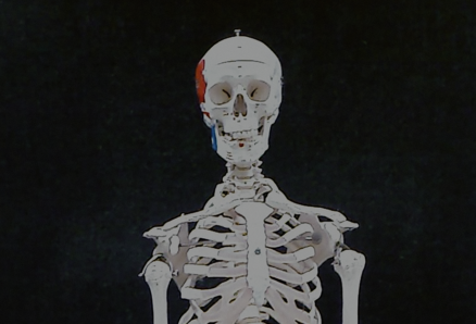 An image depicting a part of a human skeleton with a portion of the skull painted red and blue.