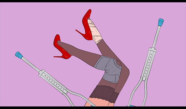 A drawing of a pair of lady legs up in the air and some crutches along them.